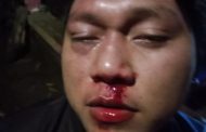 Diduga Pukul Warga Sendiri Hingga Patah Hidung, GMBI Sulut Desak Hukum Tua Talawaan Atas Dipenjarakan